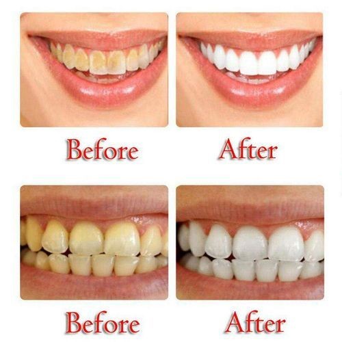 Dentrue Whitening Toothpaste - 125g